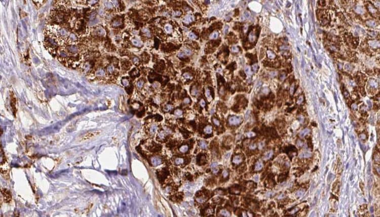 CALCR / Calcitonin Receptor Antibody