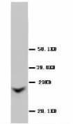 GJB2 / CX26 / Connexin 26 Antibody (Internal, Sepharose)