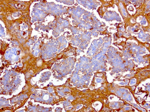 HP / Haptoglobin Antibody (clone UMAB10, Carrier-free)