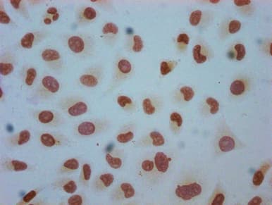 HIST1H1C Antibody