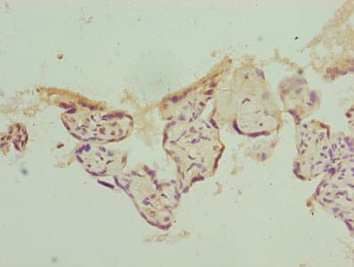 PSMD10 / Gankyrin Antibody (aa1-226)