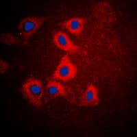 HEXB Antibody (C-Terminus)