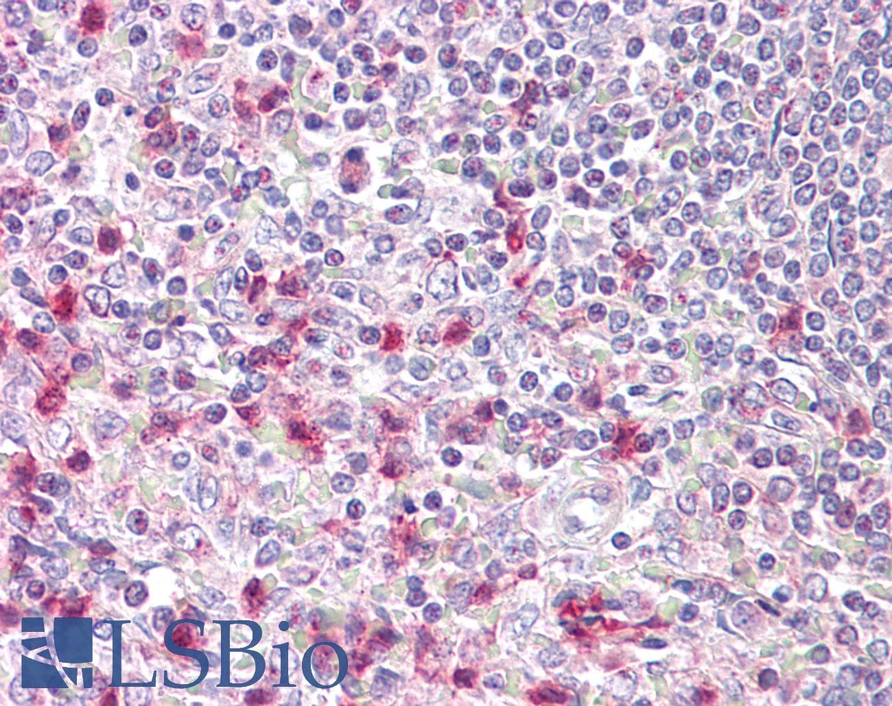 IHC-plus™ NFAT5 Antibody (aa1171-1220)