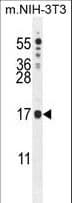 Polyclonal Rabbit anti-Human IQCJ Antibody (aa98-126, IHC, WB)