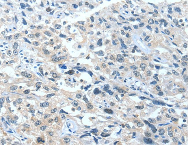 Polyclonal Rabbit anti-Human BAD Antibody (IHC)