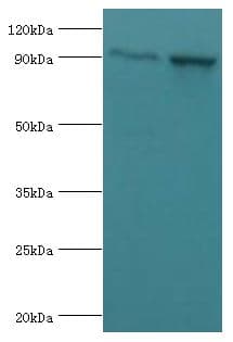 Polyclonal Rabbit anti-Human ADAM9 Antibody (aa475-685, IHC, WB)