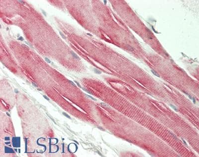 IHC-plus™ SRA1 / SRA Antibody (Internal)