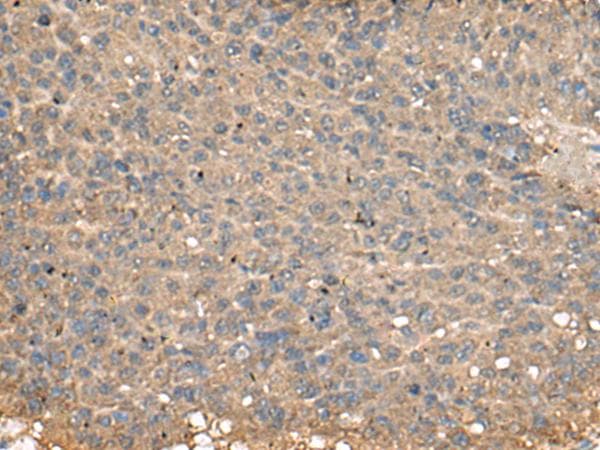 PLA2G2A / SPLA2 Antibody