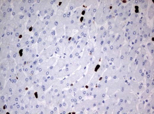 Monoclonal Mouse anti-Human PBX1 Antibody (clone UMAB111, IHC, IF)