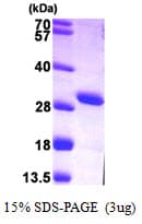 Human AK4 / Adenylate Kinase 4 Protein (Recombinant His)