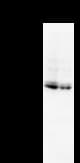 SATB2 Antibody (clone SATBA4B10)