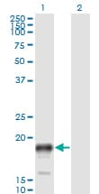 PSCA Antibody (clone 1E1)