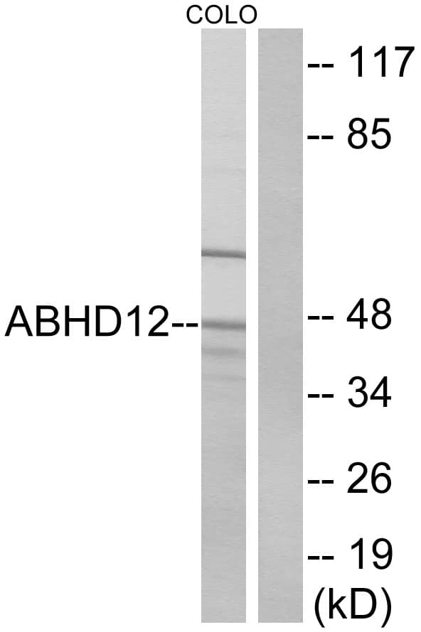 IHC-plus™ ABHD12 Antibody (aa231-280)