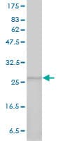 IHC-plus™ Monoclonal Mouse anti-Human PSMA7 Antibody (clone 1A10-3G12, IHC, IF, WB)