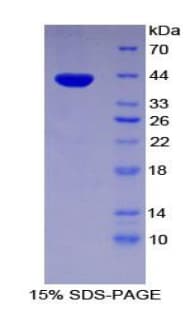 Human PYGO1 / Pygopus 1 Protein (Recombinant His-T7)
