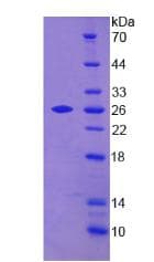Human TAGLN2 / Transgelin 2 Protein (Recombinant His)
