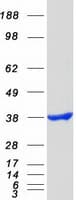 Human NT5C3A Protein (Recombinant Myc-DDK (Flag))