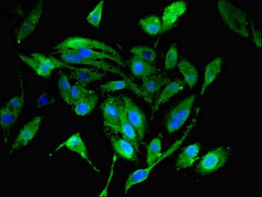 IHC-plus™ Polyclonal Rabbit anti-Human MRPL19 Antibody (aa1-292, IHC, WB)