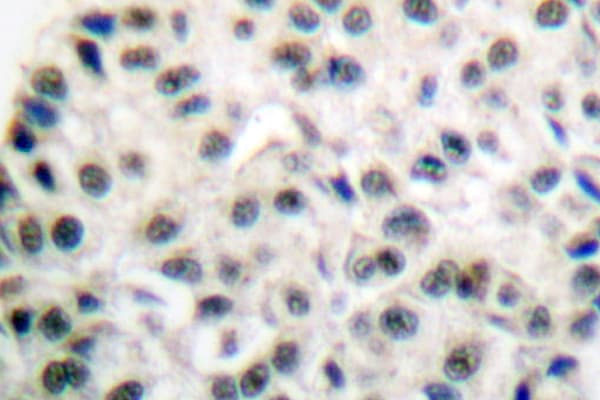 Polyclonal Rabbit anti-Human MEF2A / MEF2 Antibody (Ile402, IHC, IF, WB)