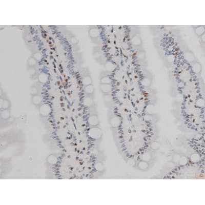 EZR / Ezrin Antibody (phospho-Tyr478)