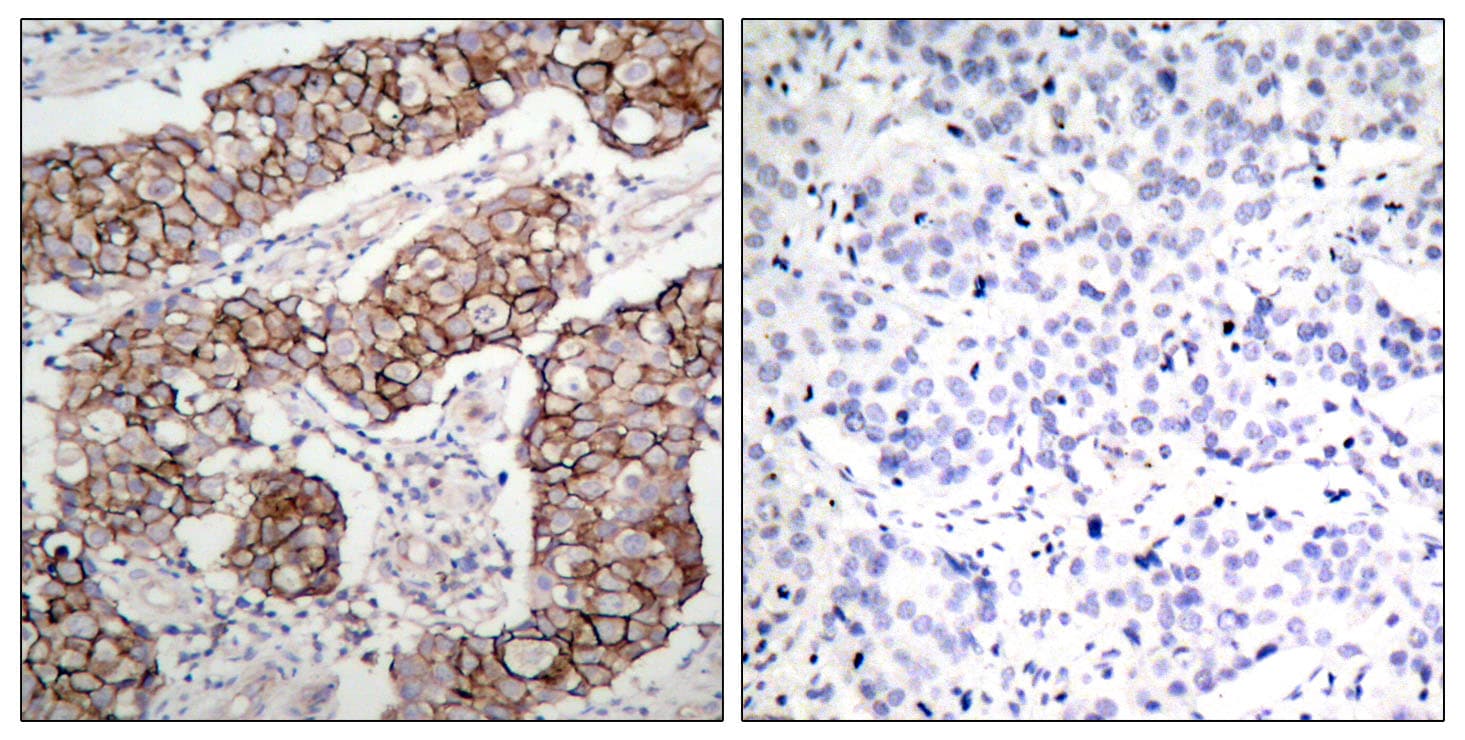 EGFR Antibody (phospho-Tyr1092)