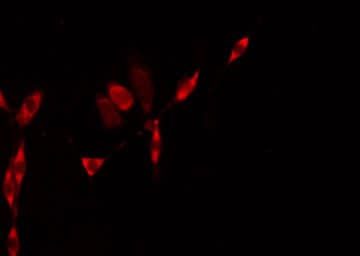 SLC9A8 / NHE8 Antibody