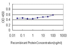 IHC-plus™ LIPA / Lysosomal Acid Lipase Antibody (clone 1F9)