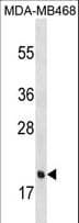 PGLYRP1 / PGRP Antibody (aa147-174)