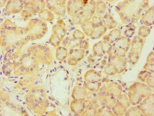FES Antibody (aa120-420)