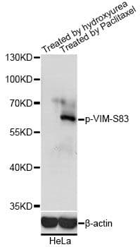 Vimentin Antibody (phospho-Ser83)