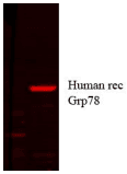 HSPA5 / GRP78 / BiP Antibody (clone 1H11-1H7)