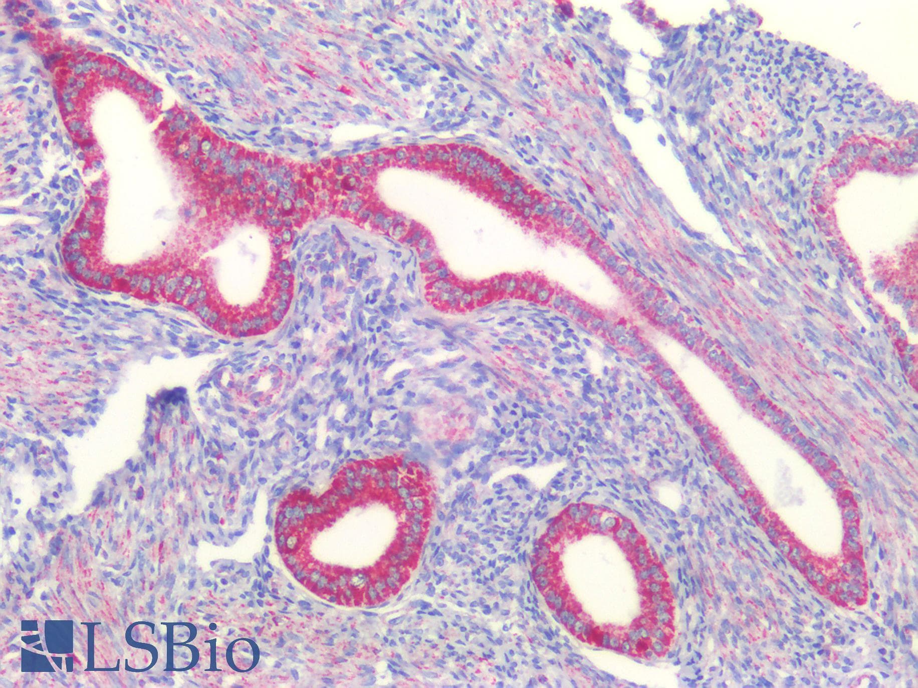 IHC-plus™ VDAC2 Antibody