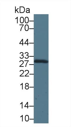 CA2 / Carbonic Anhydrase II Antibody
