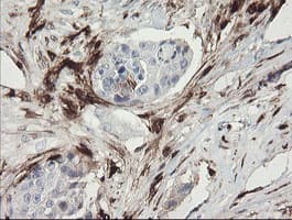 F13A1 / Factor XIIIa Antibody (clone 1H2, Carrier-free)