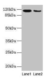 ATP2A2 / SERCA2 Antibody