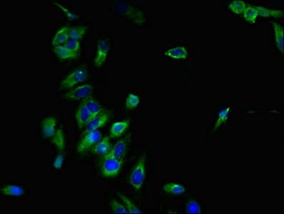 Polyclonal Rabbit anti-Human CCR7 Antibody (IHC, IF)