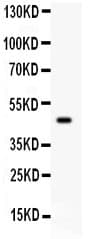 SERPINB2 / PAI-2 Antibody (aa1-180)