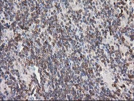 Monoclonal Mouse anti-Human PIP4K2A / PIPK Antibody (clone 3D3, Carrier-free, IHC, WB)