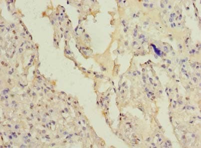 Polyclonal Rabbit anti-Human FAM124B Antibody (IHC, WB)