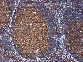 GATM / AGAT Antibody (clone OTI1E3, Carrier-free)