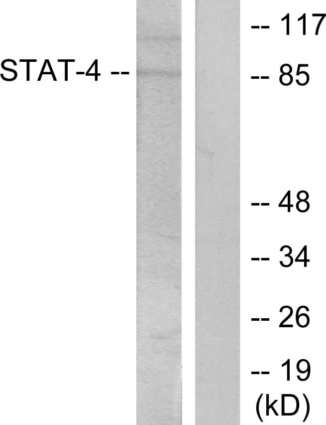 STAT4 Antibody (phospho-Tyr693)