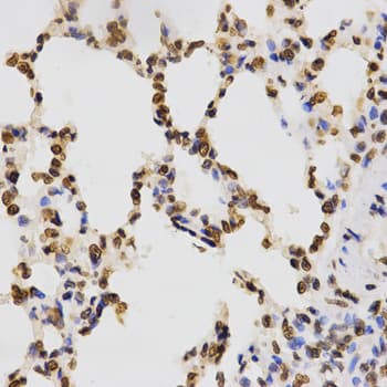 Histone H3 Antibody (Tri-Methyl-Lys9)