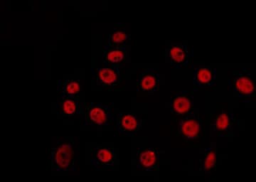 PIAS3 Antibody