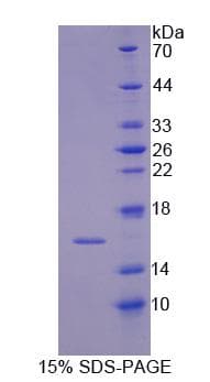 Mouse IRS4 Protein (Recombinant)