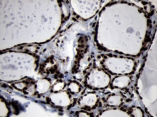 Monoclonal Mouse anti-Human HOXC4 Antibody (clone OTI1F6, IHC, WB)