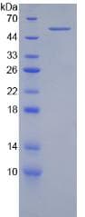 Human ITGB2 / CD18 Protein (Recombinant His-GST)