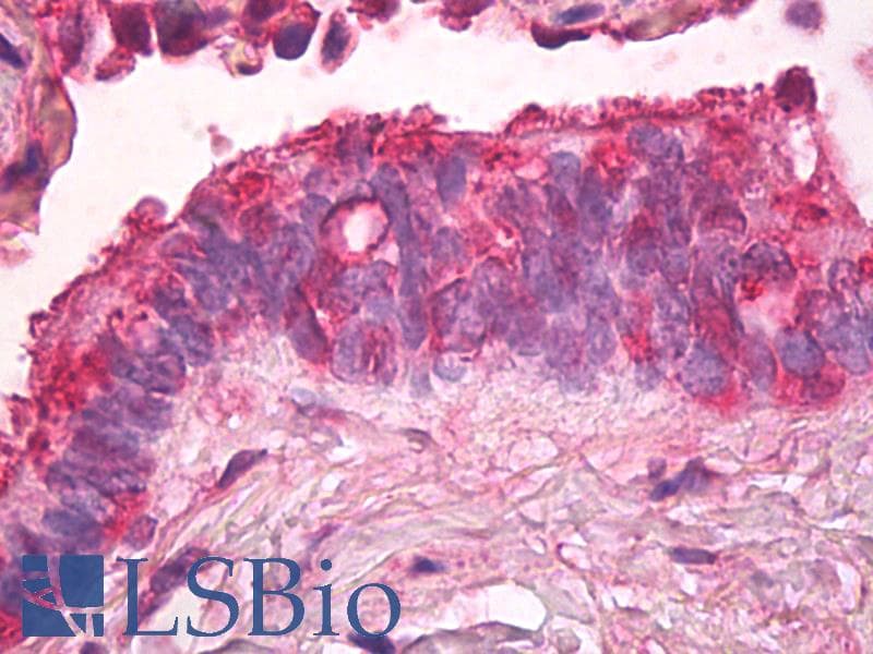 IHC-plus™ ANXA2 / Annexin A2 Antibody (N-Terminus)