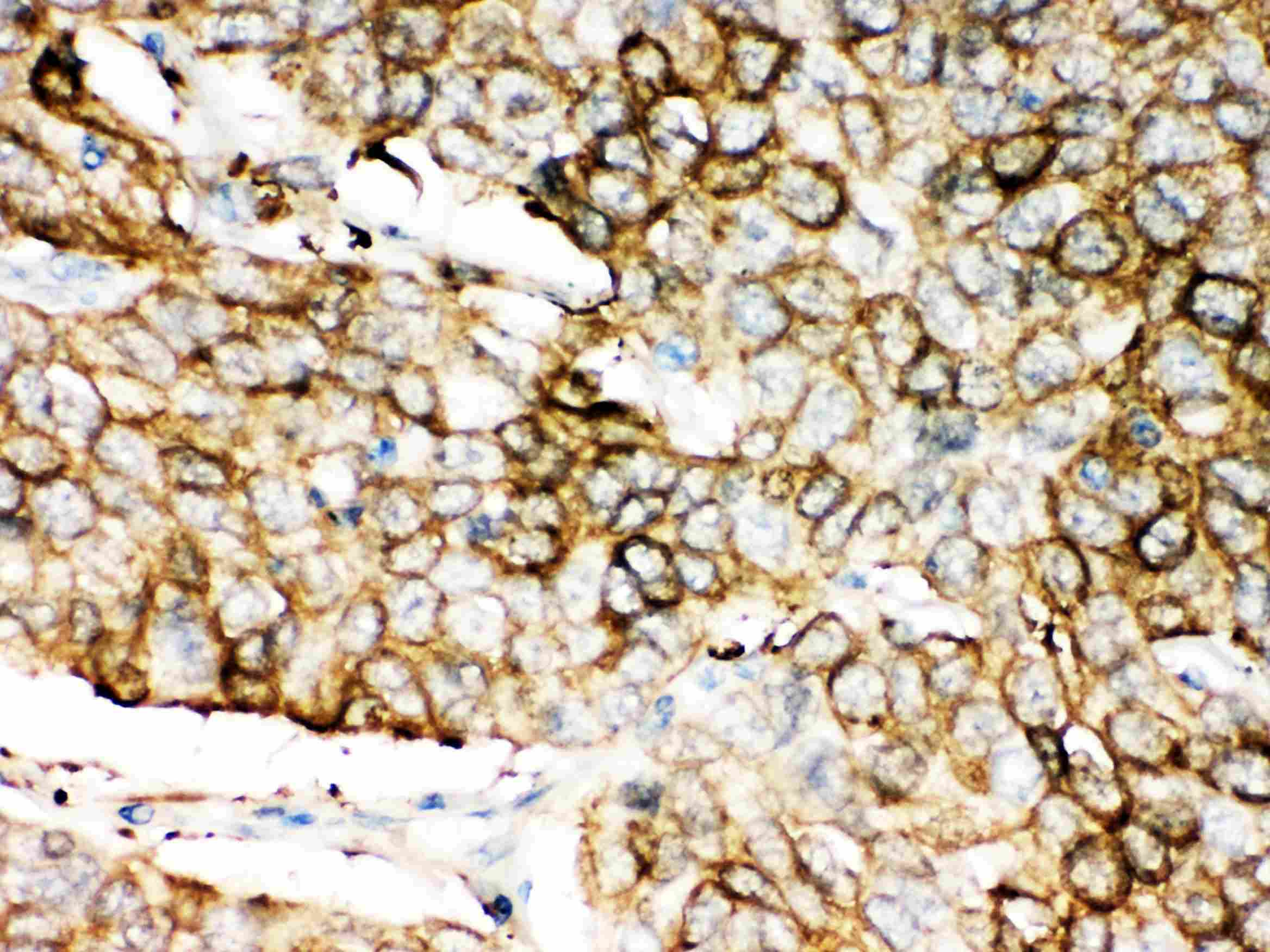 ALDH1A1 / ALDH1 Antibody (aa283-303)