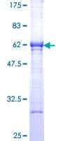 Human Esterase D / ESD Protein (Recombinant GST)