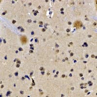 LBR / Lamin B Receptor Antibody